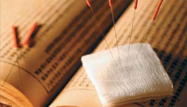 银针游走江湖记：那些扎进生活里的奇妙魔法