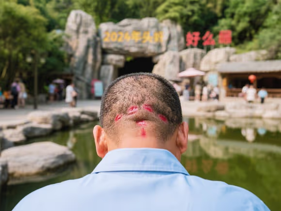 头后脑勺好痛景区